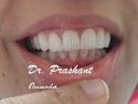 Dent Cure – A Multi Speciality Dental Clinic