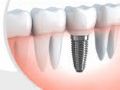 Dr. Garg's Multispeciality Dental Clinic