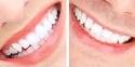 Dr. Sood Dental Clinic