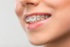 Family Dental Care Centre