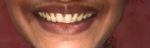 Perfect Smile Dental Care