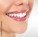 Bright Smile Dental Clinic