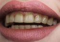 Soni Dental Multispeciality Centre