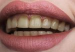 Khatri Dental Care