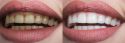Balaji Dental Clinic