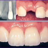 Rana Dental Implant & Cosmetic Clinic